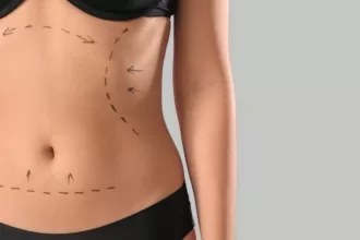A woman with a tummy, showcasing a line drawn on her stomach, symbolizing body positivity and the journey of a body lift.
