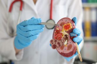 Kidney transplant surgery being performed by a skilled medical team