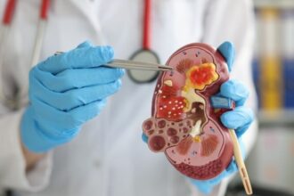 kidney transplant procedure in india for international patients