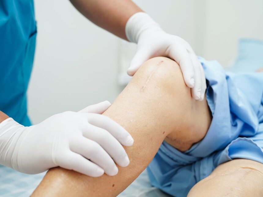 Knee replacement surgery cost discussion with doctor and patient