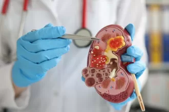 Laparoscopic nephrectomy benefits