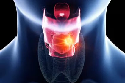 An image showing the thyroid gland highlighted in red, relevant to laryngectomy procedures and voice box surgery.