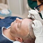 Laser hair removal cost in India