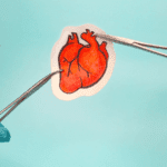 New Advances in Heart Surgery