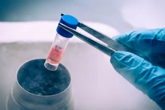 Advancements in Organ Transplantation