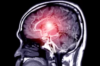 Step-by-step guide on how to detect brain tumor symptoms at home.