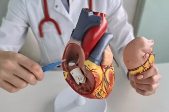 Illustration of mitral valve replacement surgery showing a surgeon implanting a mechanical valve in a human heart.