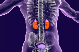 A medical procedure showing renal angioplasty and stenting, with a catheter inserted to widen a narrowed renal artery and place a stent.